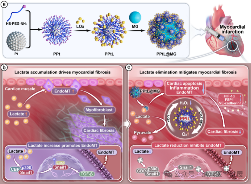 Biomaterials��΢����ê���ļ�����ǿ��Pt����ø�����Ĺ�΢����